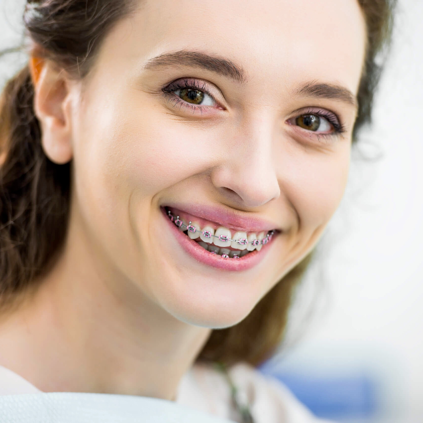 Metal Braces: Comfortable and Discreet Orthodontics