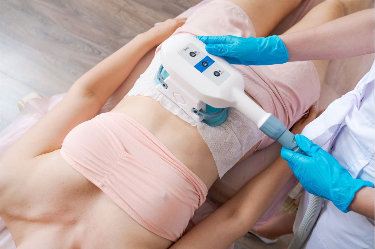 How Much Does CoolSculpting Cost in Dubai? Factors and Insights