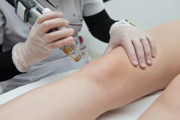 Electrolysis vs. Laser Hair Removal Choosing the Best Option for Smooth Skin in Dubai