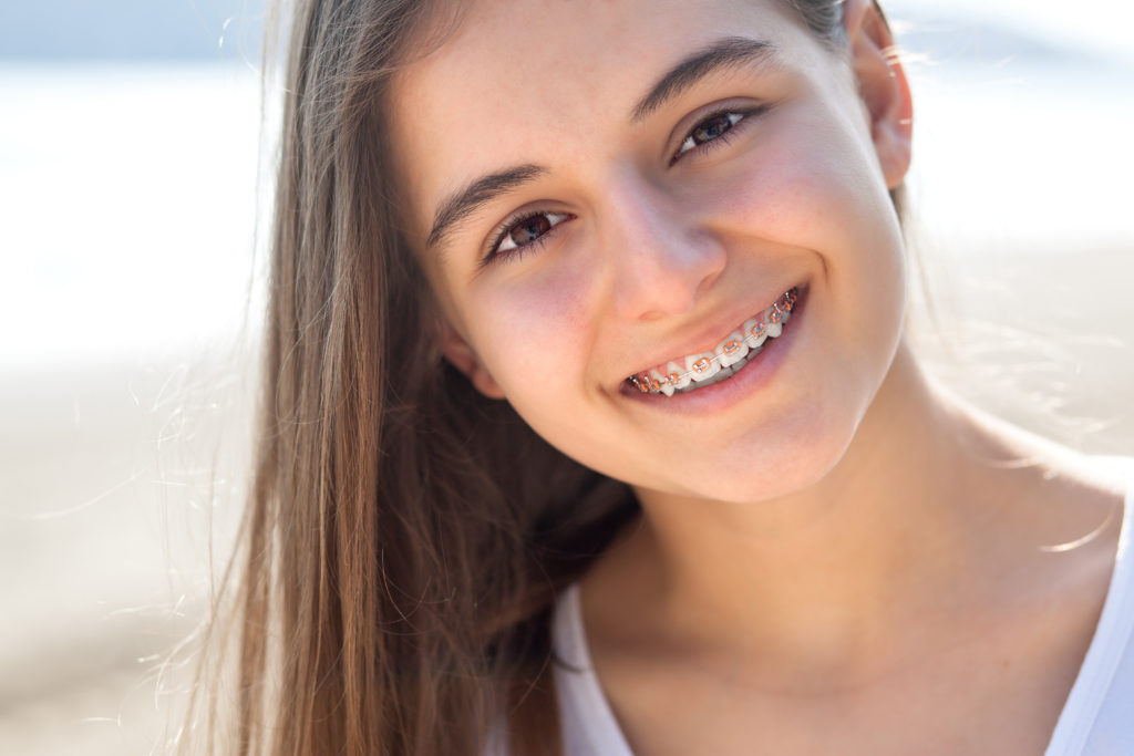 What to Expect with Metal Braces Treatment