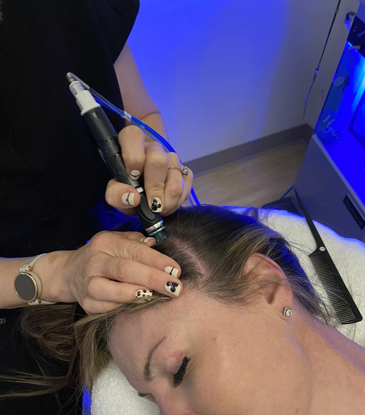 Why Hydrafacial Scalp Treatment is a Game Changer