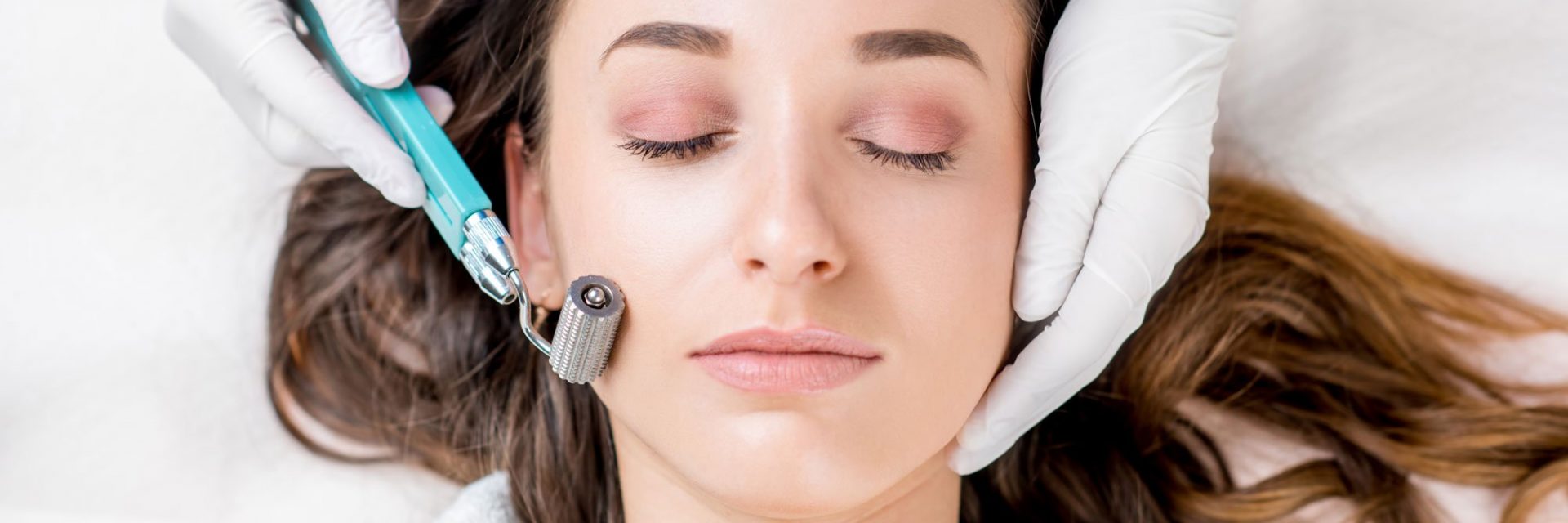 Microneedling Wonders: Reveal Your Best Skin