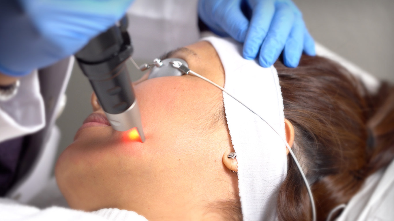 Pico Laser Treatment: Common Myths Debunked