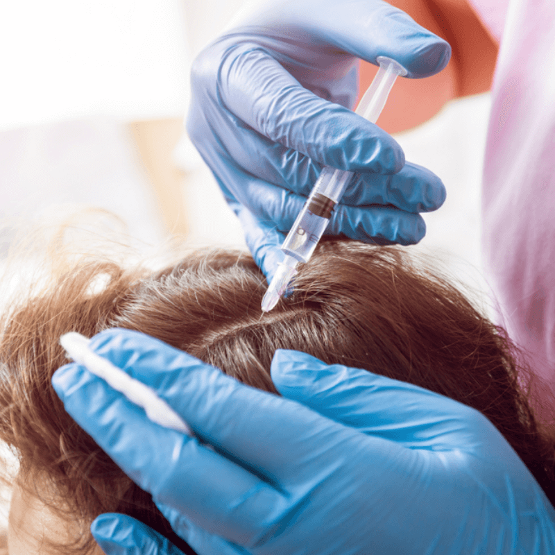 PRP for Women: Can It Help with Female Pattern Baldness?