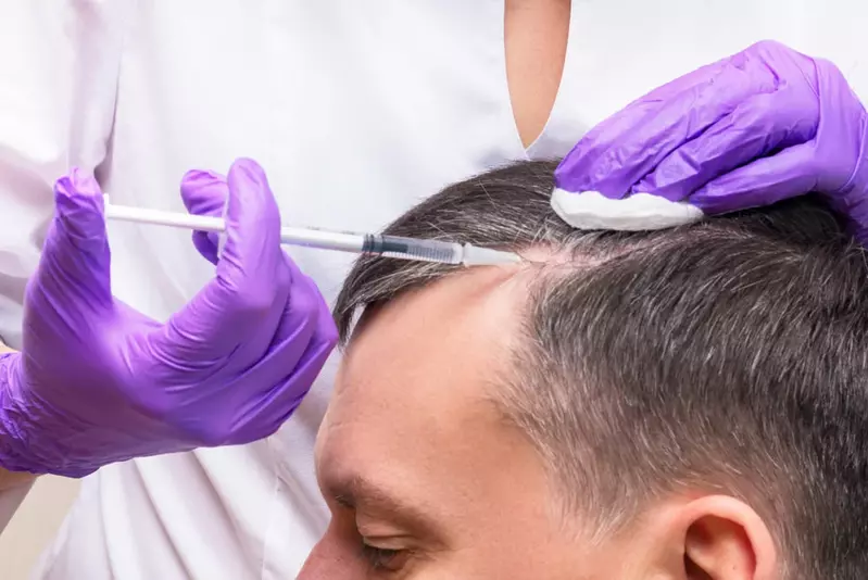 The Best Times to Consider PRP Hair Therapy in Dubai