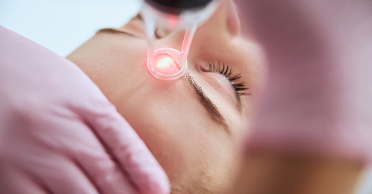 Pico Laser Treatment: Restore Your Skin’s Glow