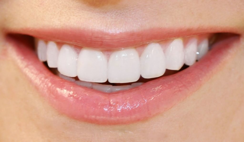 How Much Should You Pay for Teeth Whitening in Dubai?