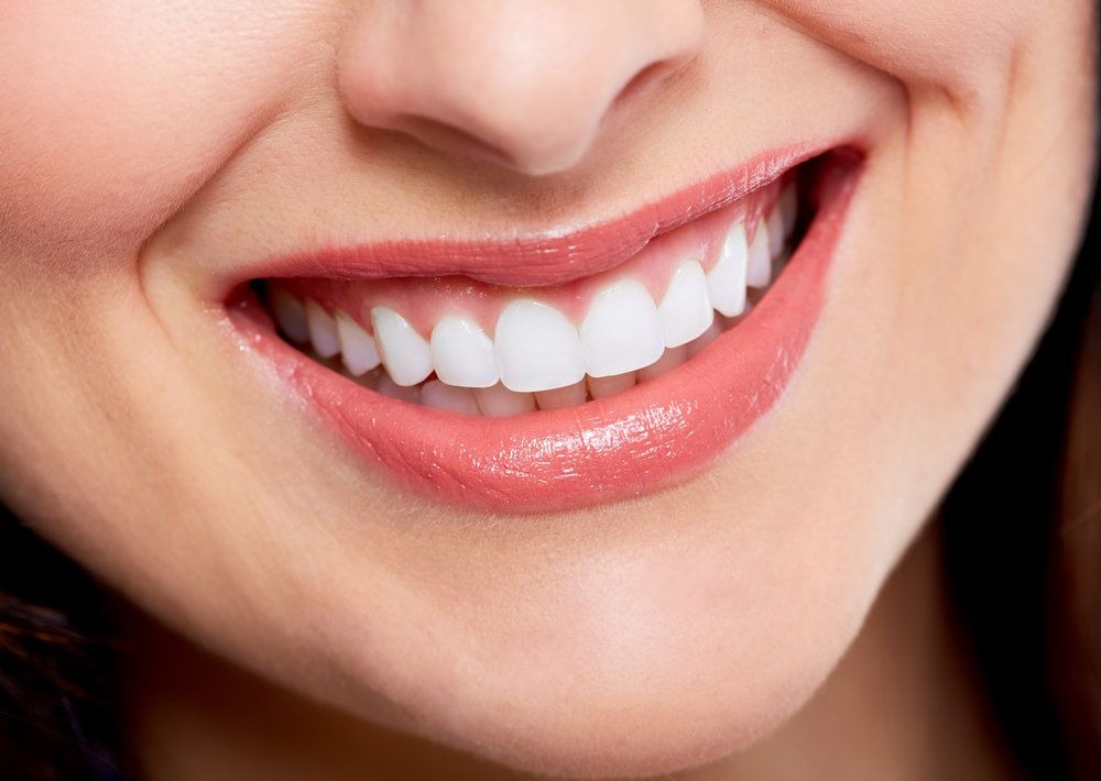 Average Cost of Professional Teeth Whitening in Dubai