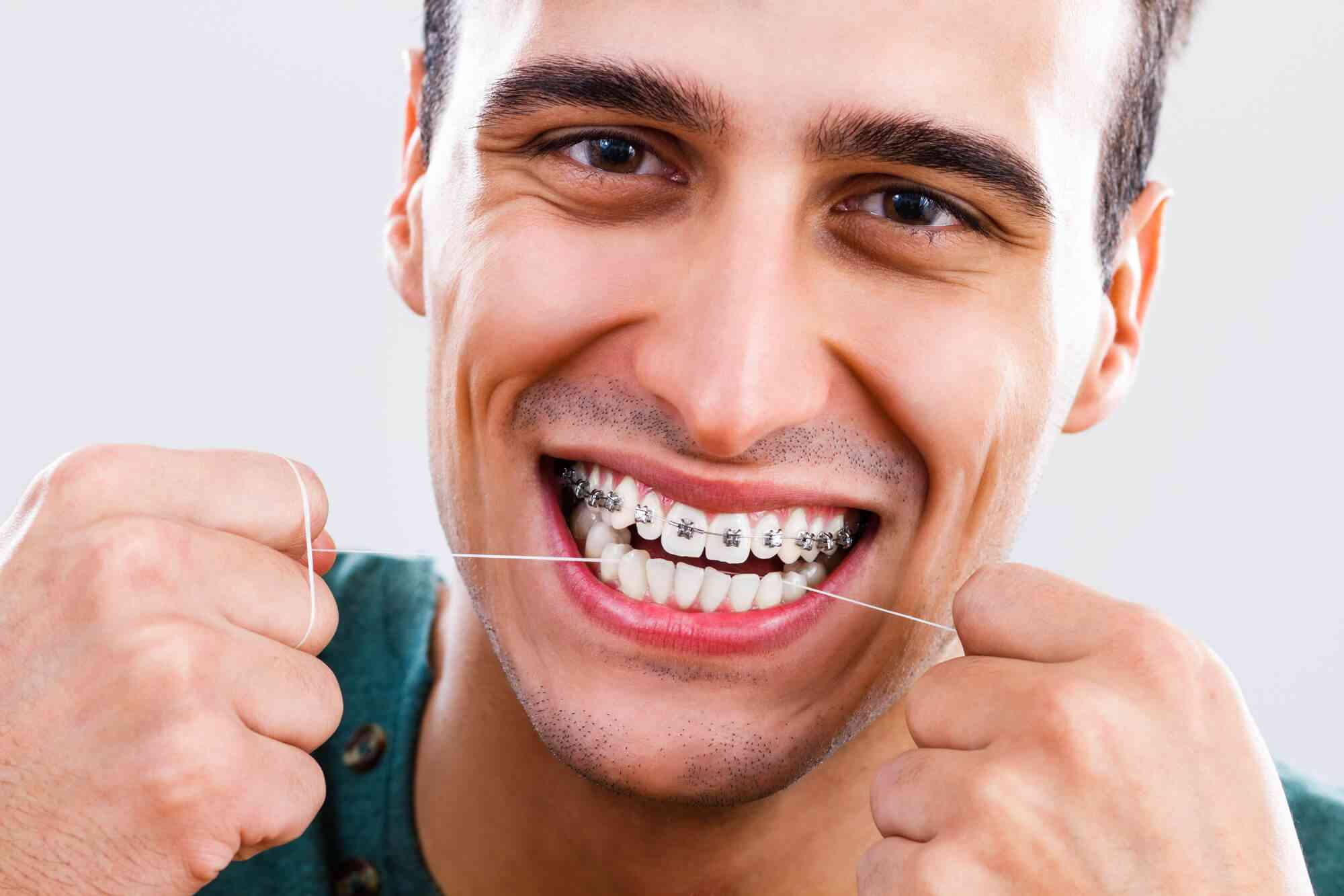 Metal Braces: Fast and Effective Orthodontic Treatment