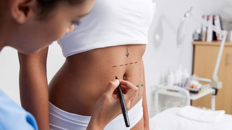 Top Surgeons for Tummy Tuck Surgery in Dubai Reviews and Ratings