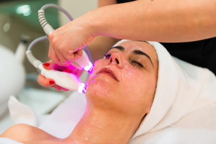 Pico Laser Treatment: Quick Fix for Great Skin