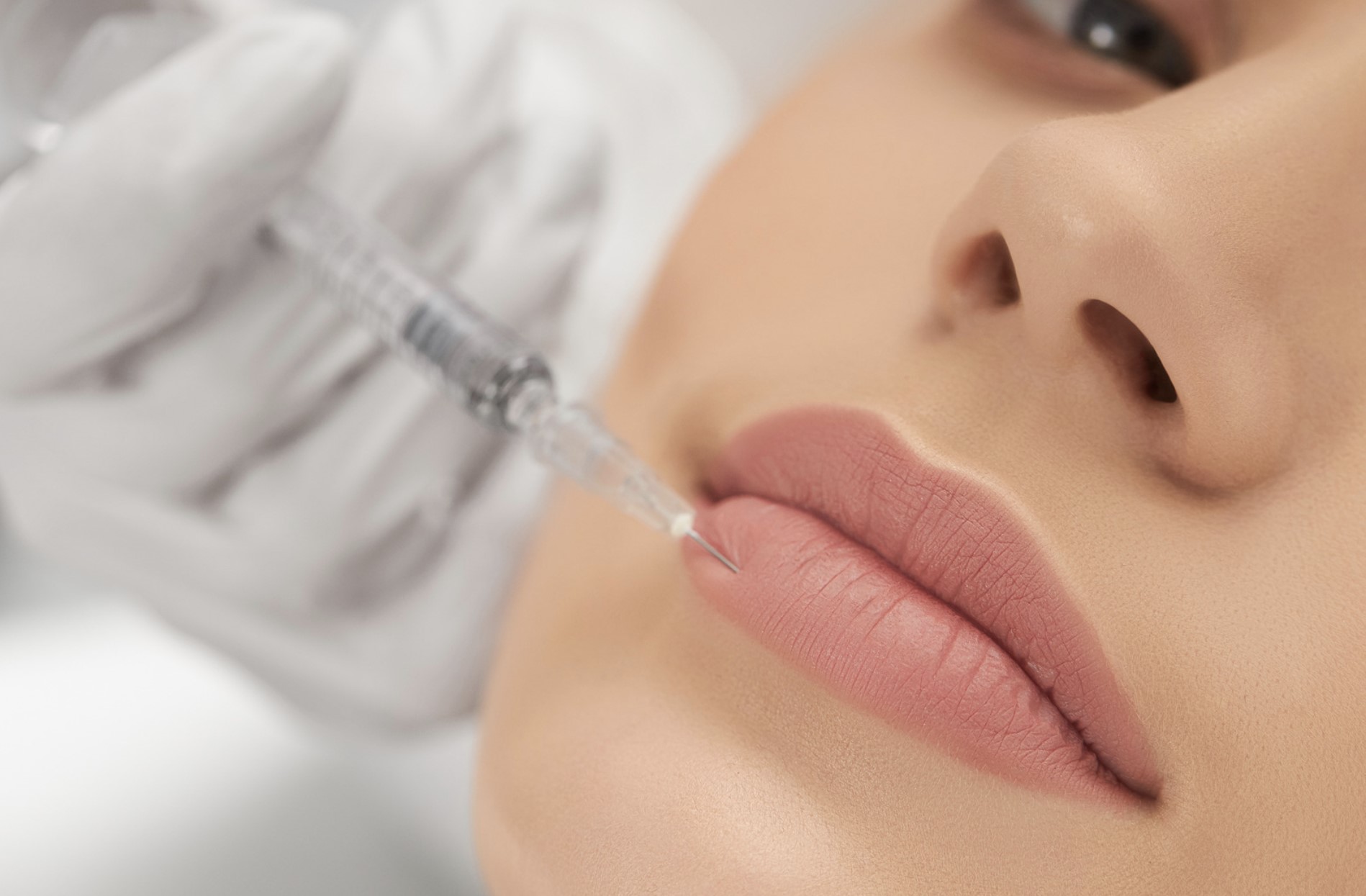 Cost of Lip Fillers in Dubai: What You Should Know