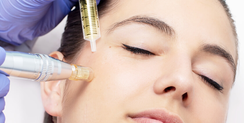 Revitalize Your Skin with Mesotherapy in Dubai