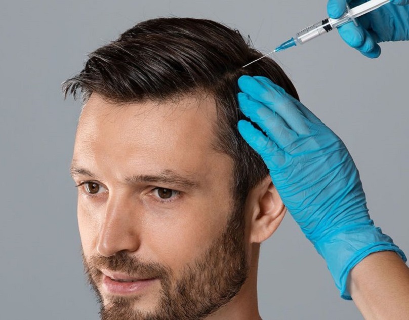 Why ACell PRP Therapy is the Top Choice for Hair Restoration in Dubai