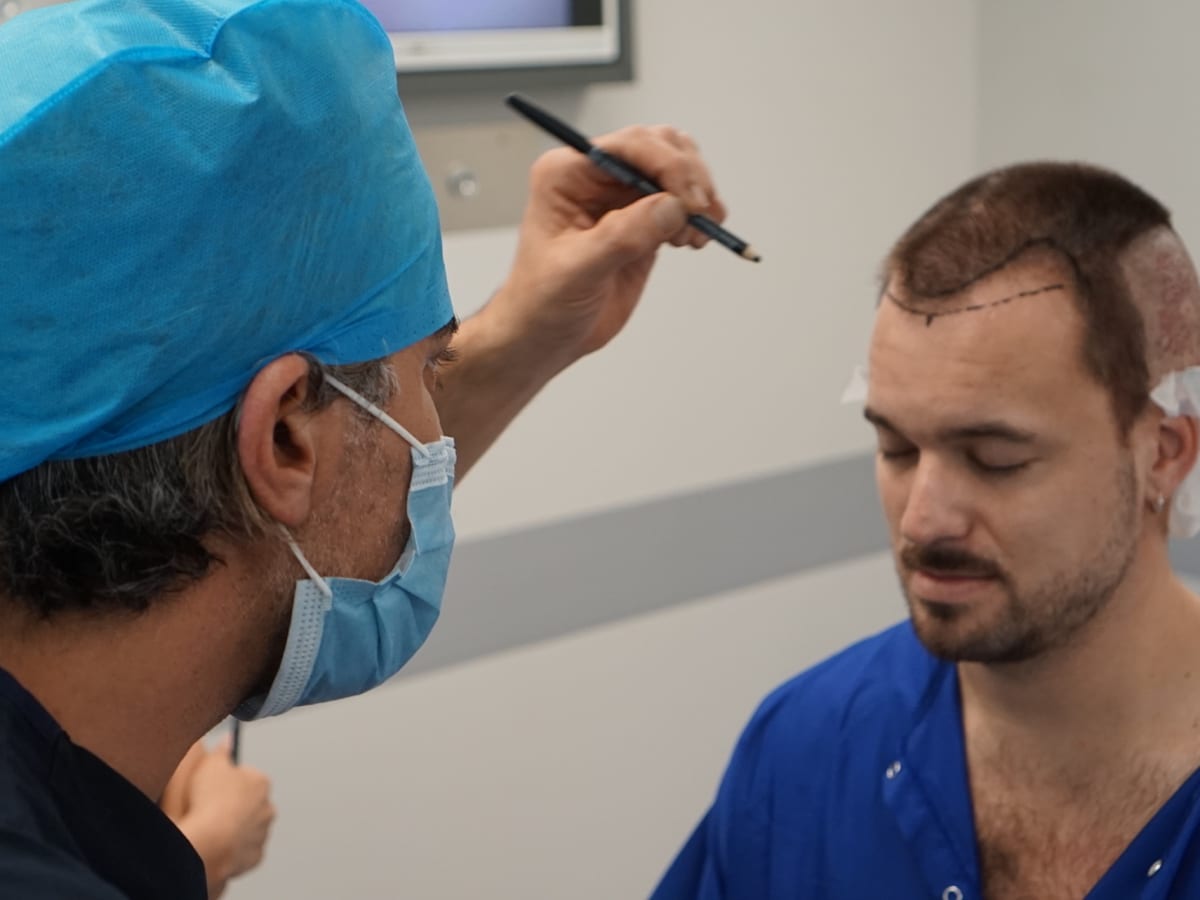 Hair Transplant Cost: Comparing Different Clinics