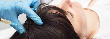 The Science Behind PRP Hair Treatments Unveiled