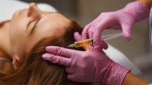 Rejuvenate Your Hair with PRP Treatment Benefits