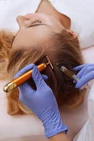 Unlock the Benefits of PRP Hair Treatment Now