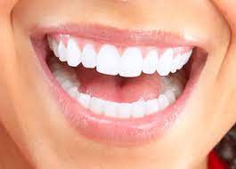 Best Deals on Composite Veneers Cost in Dubai