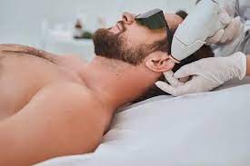 Top Men Laser Hair Removal Treatments in Dubai