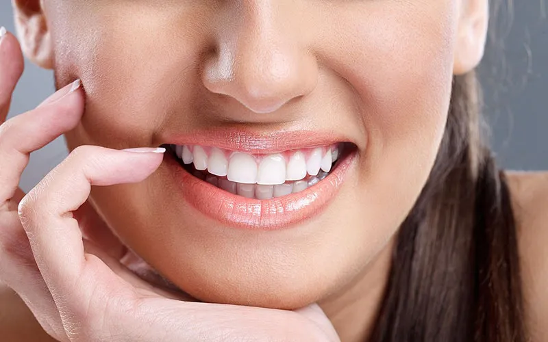 Dental Veneers in Dubai: The Secret to a Stunning Smile