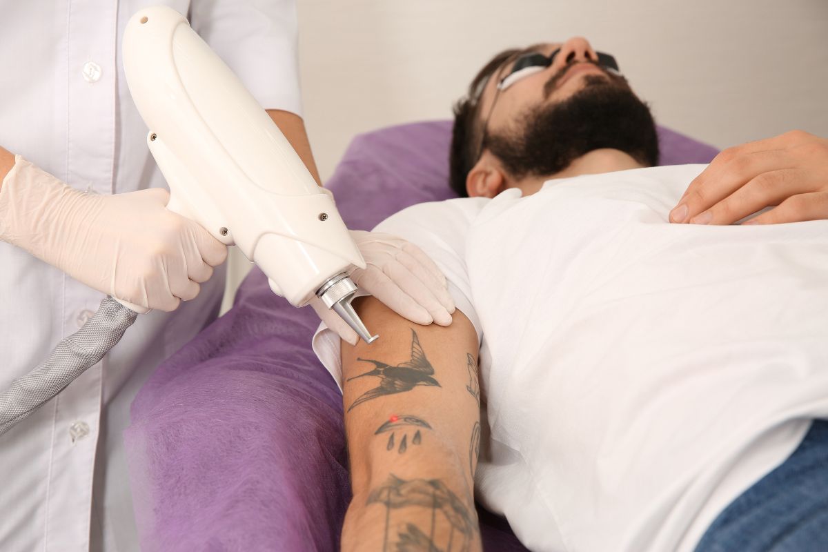 Embrace Change with Laser Tattoo Removal Options