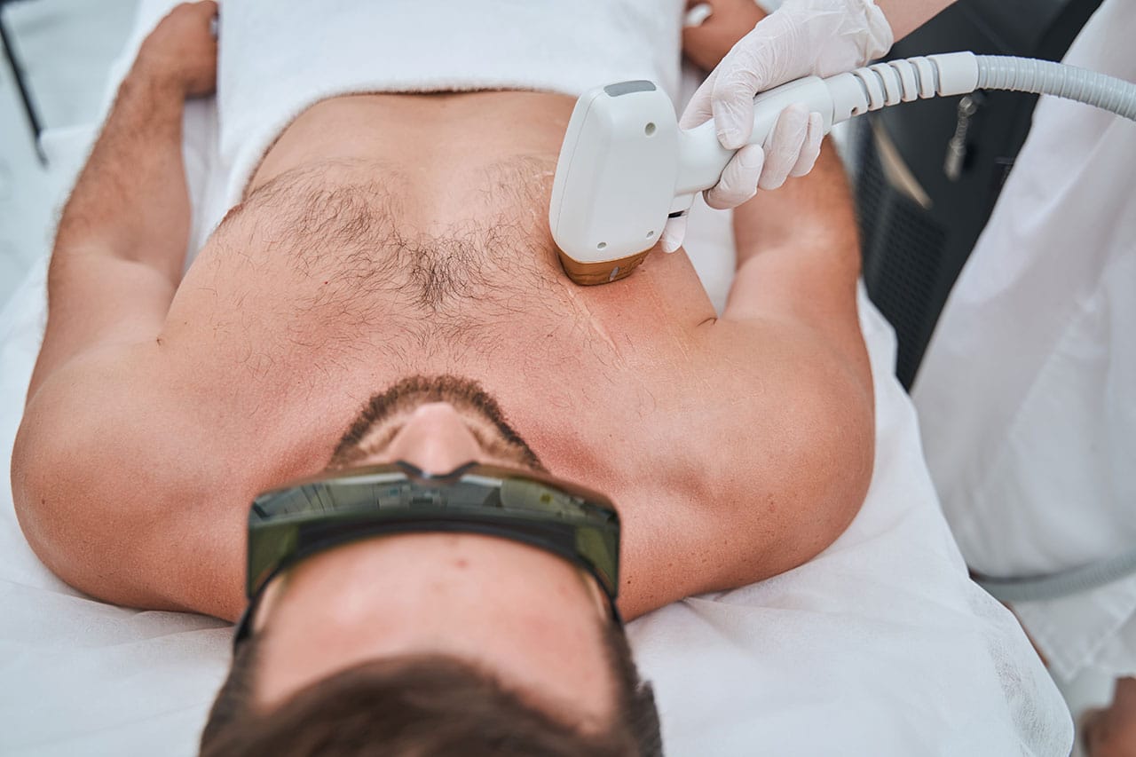 Top Reasons for Men Laser Hair Removal in Dubai