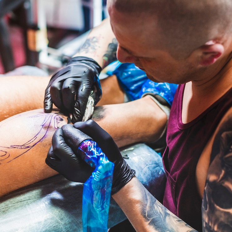 Uncover the Secrets of Laser Tattoo Removal