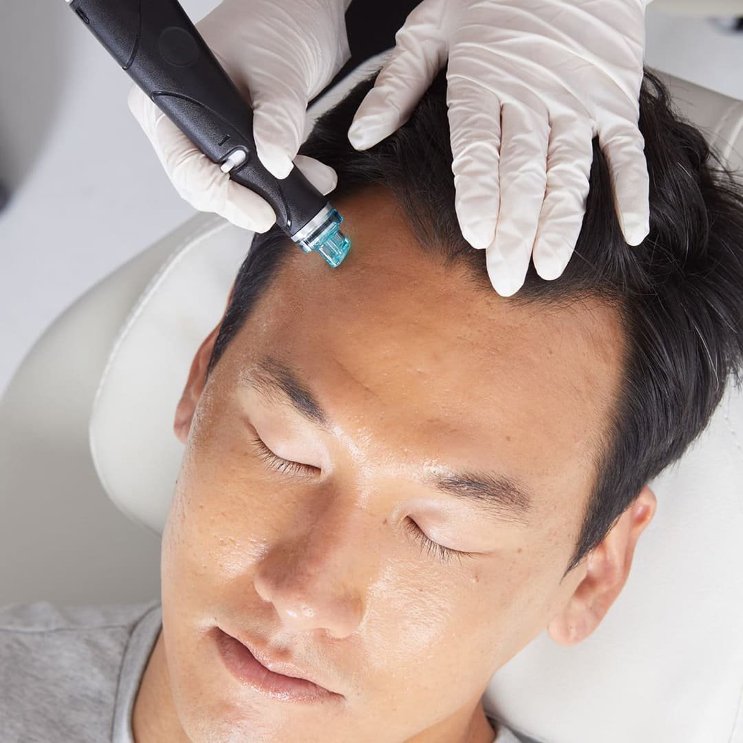 Elevate Your Skincare with Hydrafacial for Men in Dubai