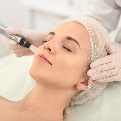 Uncover the Truth About Microneedling