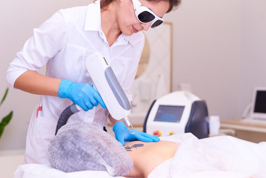 Laser Tattoo Removal: The Art of Skin Rejuvenation