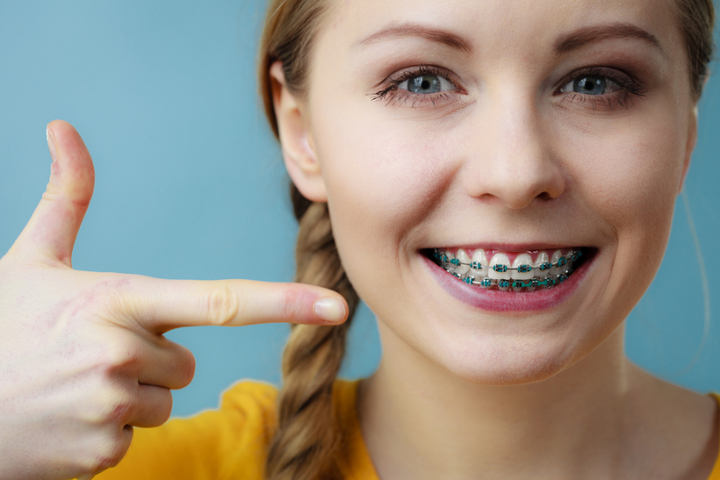 Metal Braces in Dubai: Your Key to Dental Health