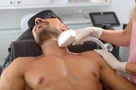 Men Laser Hair Removal in Dubai: FAQs Answered